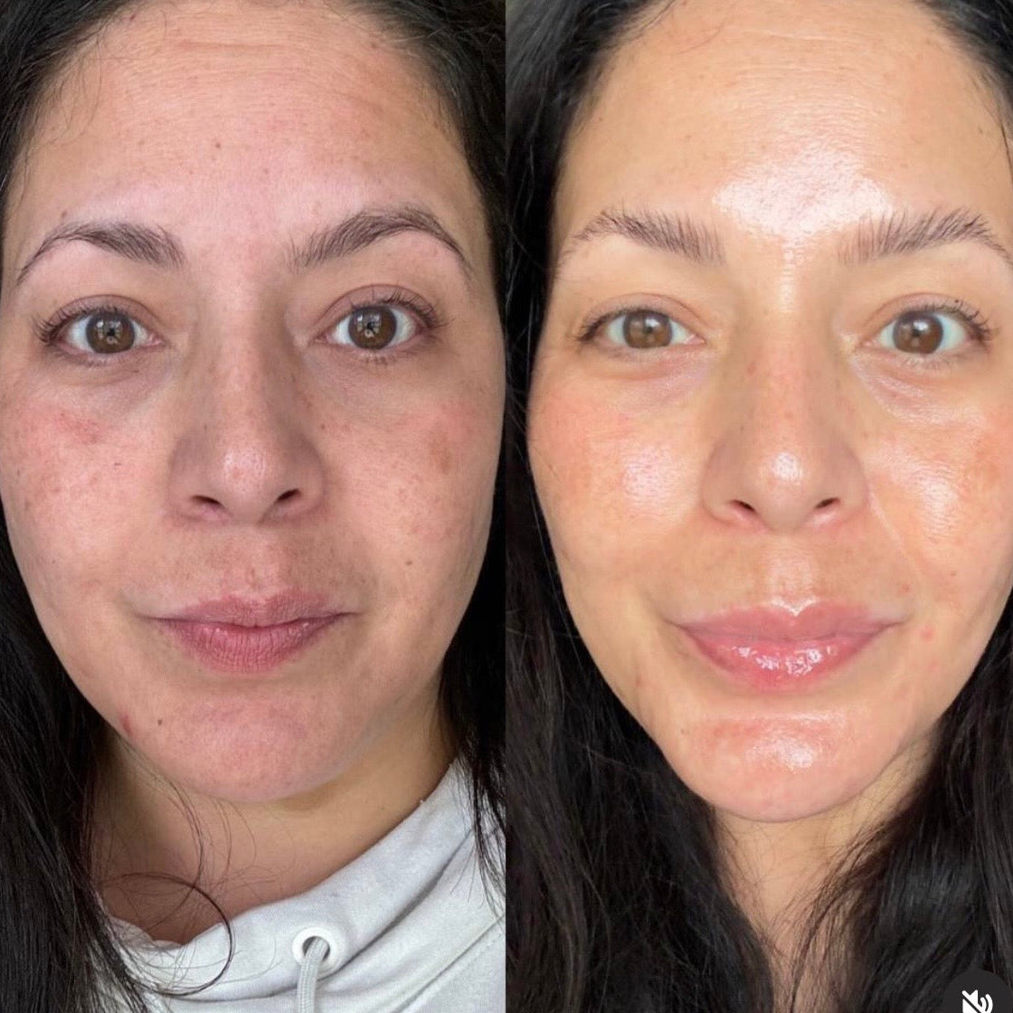 Stap 3: anti-age olie-sérum. Natuurlijk retinol alternatief.