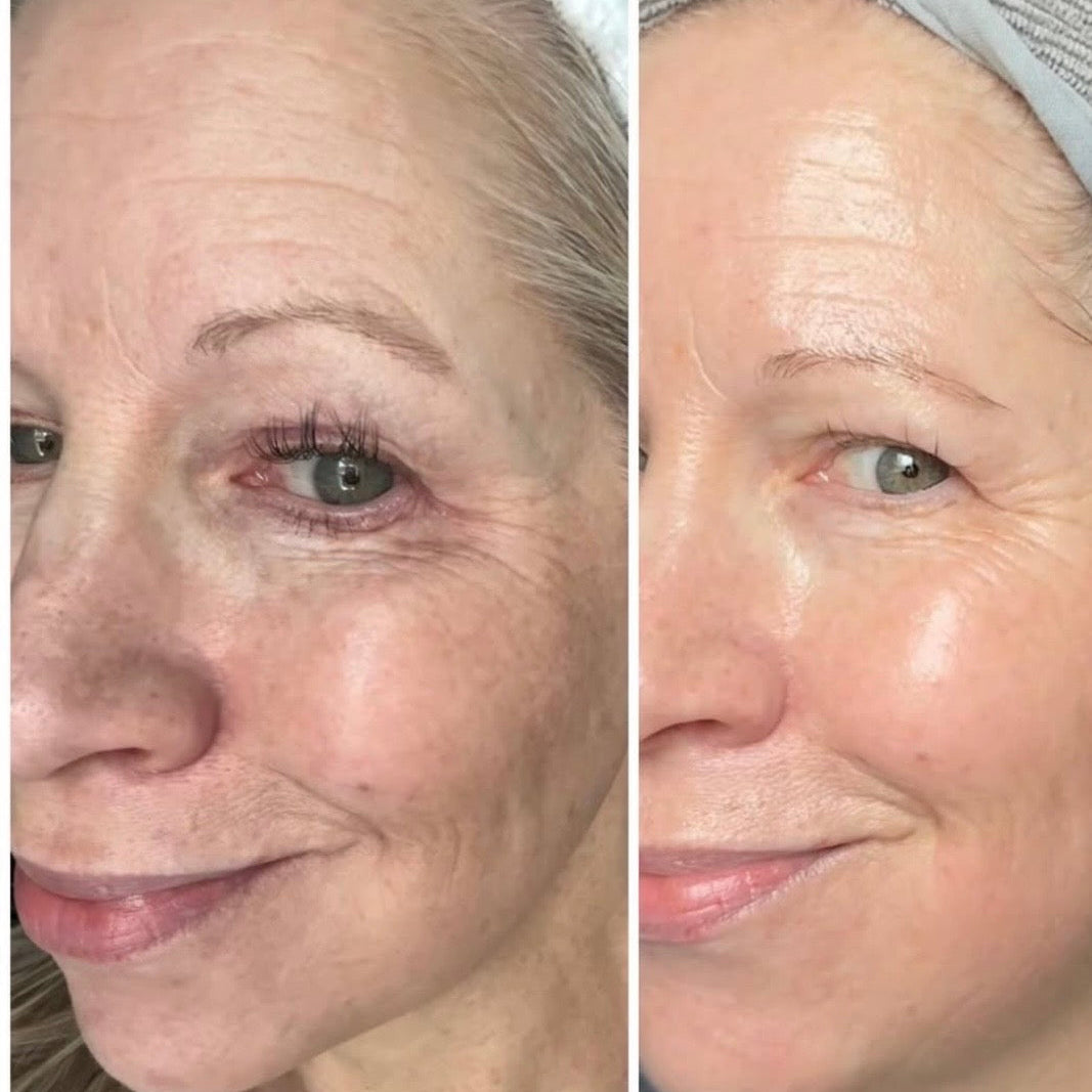 Stap 4. Anti-age dag/nachtcrème met biologisch alternatief voor retinol.