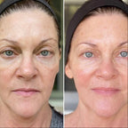 Stap 4. Anti-age dag/nachtcrème met biologisch alternatief voor retinol.