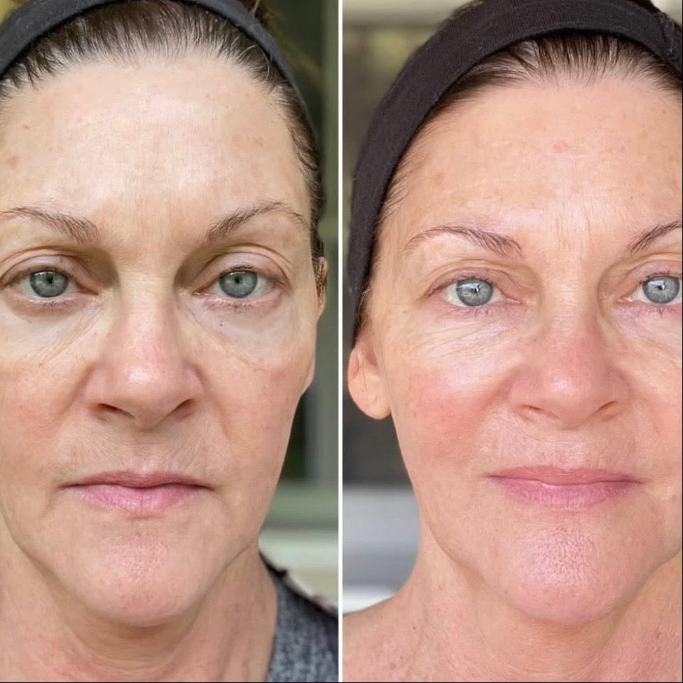 Stap 4. Anti-age dag/nachtcrème met biologisch alternatief voor retinol.