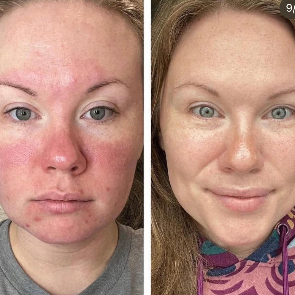 Stap 3: anti-age olie-sérum. Natuurlijk retinol alternatief.